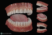 高精度CG牙齿舌头口腔模型贴图纹理源文件teeth zbrush